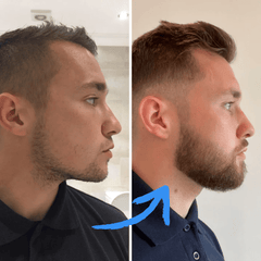 Valhalla Beard Growth Kit Bundle